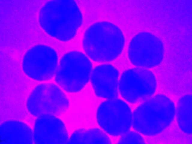 Image of silver nanoparticles from Korin Wheelers lab taken with a transmission electron microscope and modified by Takeshi Moro.